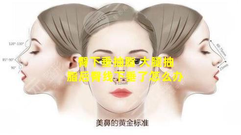 臀下垂抽脂 大腿抽脂后臀线下垂了怎么办